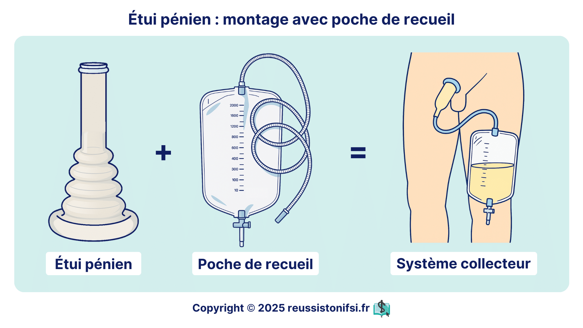 etui-penien-montage-poche-recueil-dispositif-urinaire.png